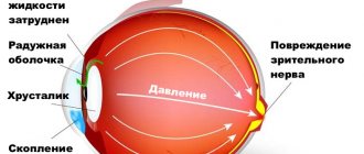 болит голова ухудшилось зрение