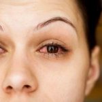 Болят глаза при простуде