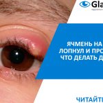 что делать если лопнул ячмень