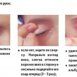 Что делать, если в глаз попала соринка