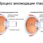 Что такое аккомодация глаза