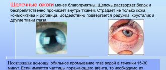 Что такое ожоги глаз