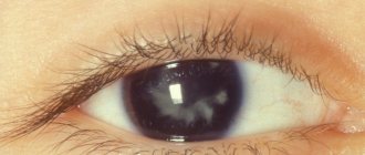 Что такое зрачок глаза