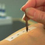 Чтобы определить причину аллергии, проводят специальный тест