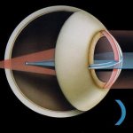 дефект зрения