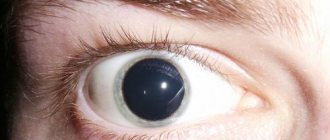 Action of the drug.