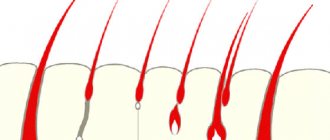 dermal papilla of eyelashes