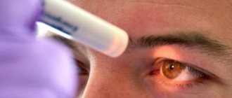 Diagnosis of pupil size by an ophthalmologist