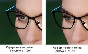 Эффект увеличения глаз при высоких диоптриях