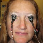 Electrophysiological examination of the eyes (EPS)