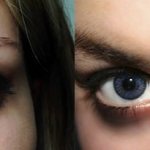 Глаза хамелеон у человека