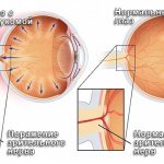 Глазное давление норма 60 лет