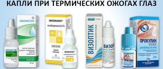 Глазные капли при термических ожогах