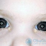 гной в глазах утром