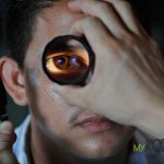 Himicheskie ozhogi glaz - Шуманит попал в глаза что делать