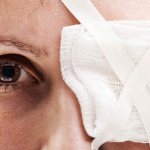 химический ожог роговицы глаза