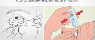 Использование капель и мази