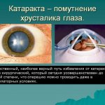 Как вести себя после операции по удалению катаракты глаза (замене хрусталика на иол)