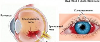 Как возникает патология