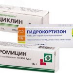 Как выглядит внутренний ячмень на нижнем веке: лечение внутри нижнего и верхнего века