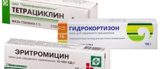 Как выглядит внутренний ячмень на нижнем веке: лечение внутри нижнего и верхнего века