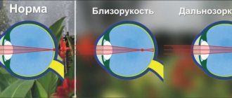 Picture of eyes