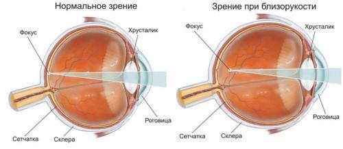 Комплекс упражнений глаз по методике профессора жданова - отзывы