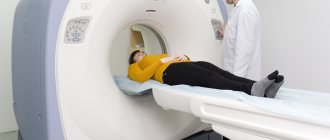 Computed tomography of the head