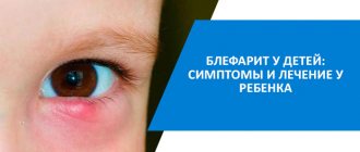 treatment of blepharitis in a child