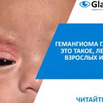 лечение гемангиомы глаз