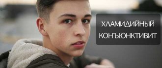 лечение хламидийного конъюнктивита