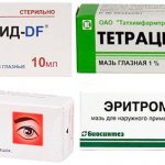 Лекарственные препараты от отёчности верхнего века