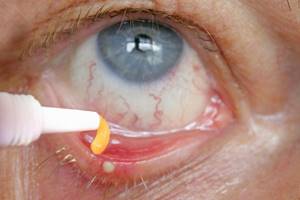 Левомицетиновая (Levomycetin) мазь для глаз. Инструкция по применению, цена
