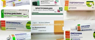 мазь от ячменя на глазу