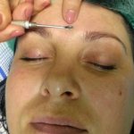 механический способ удаления поросянки на лице