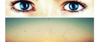 мушки перед глазами