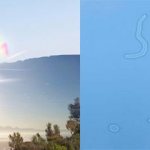 Floaters in the eyes