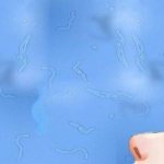 Мушки в глазу как лечить народными средствами