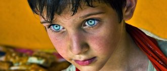 Необычный цвет глаз