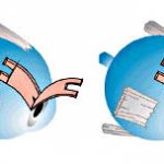 Non-penetrating deep sclerectomy (NGSE) - surgery for glaucoma