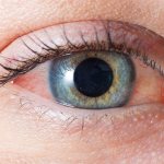 Офтальмологи называют конъюнктивитом воспаление слизистой глаза