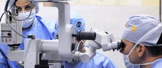 Cataract surgery