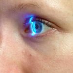 Острый приступ глаукомы