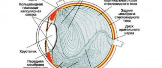отслоение сетчатки