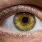 Отслоение сетчатки