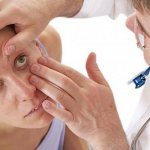 отслойка стекловидного тела глаза