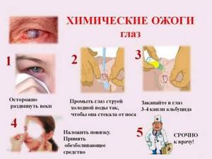 первая помощь при химических ожогах глаз