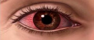 покрасневшие глаза