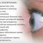 Причины экзофтальма