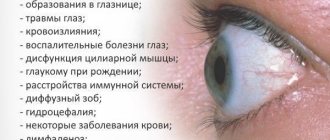 Причины экзофтальма